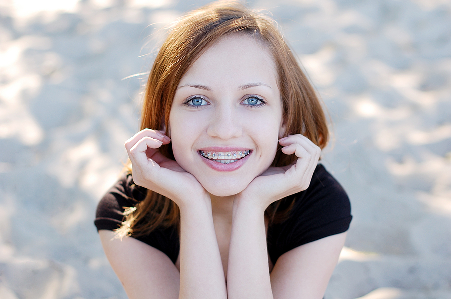 Transforming Smiles: Everything You Need to Know About Braces