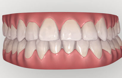 https://www.dentalspecialistsofny.com/wp-content/uploads/2026/03/ba-gallery-after1.jpg