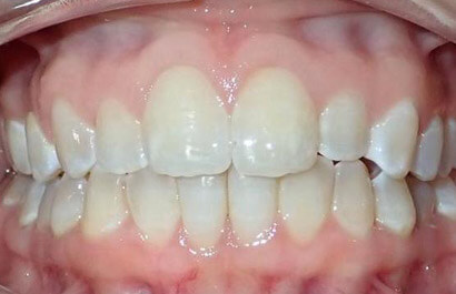 https://www.dentalspecialistsofny.com/wp-content/uploads/2026/03/ba-gallery-after10.jpg