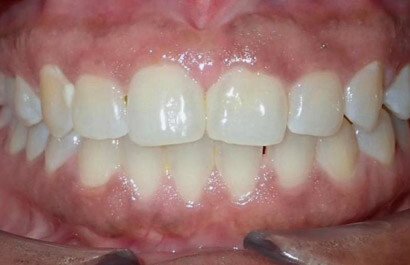 https://www.dentalspecialistsofny.com/wp-content/uploads/2026/03/ba-gallery-after16.jpg