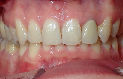 https://www.dentalspecialistsofny.com/wp-content/uploads/2026/03/ba-gallery-after17.jpg