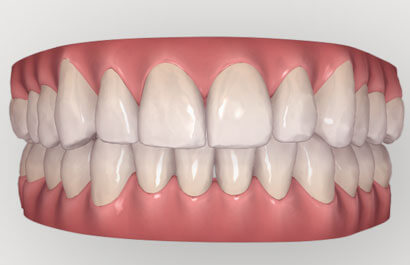 https://www.dentalspecialistsofny.com/wp-content/uploads/2026/03/ba-gallery-after2.jpg