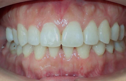 https://www.dentalspecialistsofny.com/wp-content/uploads/2026/03/ba-gallery-after20.jpg