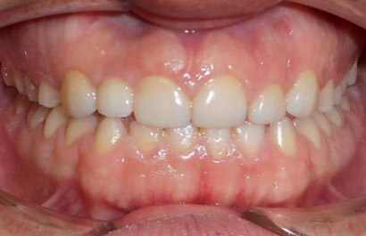 https://www.dentalspecialistsofny.com/wp-content/uploads/2026/03/ba-gallery-after3.jpg