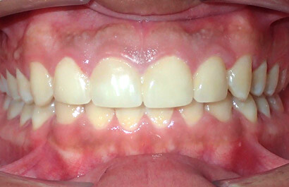 https://www.dentalspecialistsofny.com/wp-content/uploads/2026/03/ba-gallery-after4.jpg