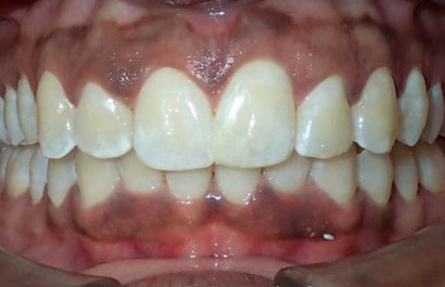 https://www.dentalspecialistsofny.com/wp-content/uploads/2026/03/ba-gallery-after5.jpg