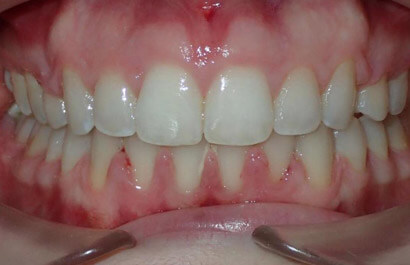 https://www.dentalspecialistsofny.com/wp-content/uploads/2026/03/ba-gallery-after8.jpg