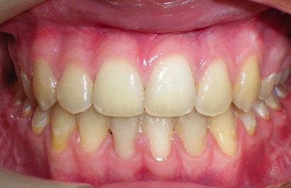 https://www.dentalspecialistsofny.com/wp-content/uploads/2026/03/ba-gallery-after9.jpg